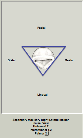 Mx Lateral Incisal Triangular.png